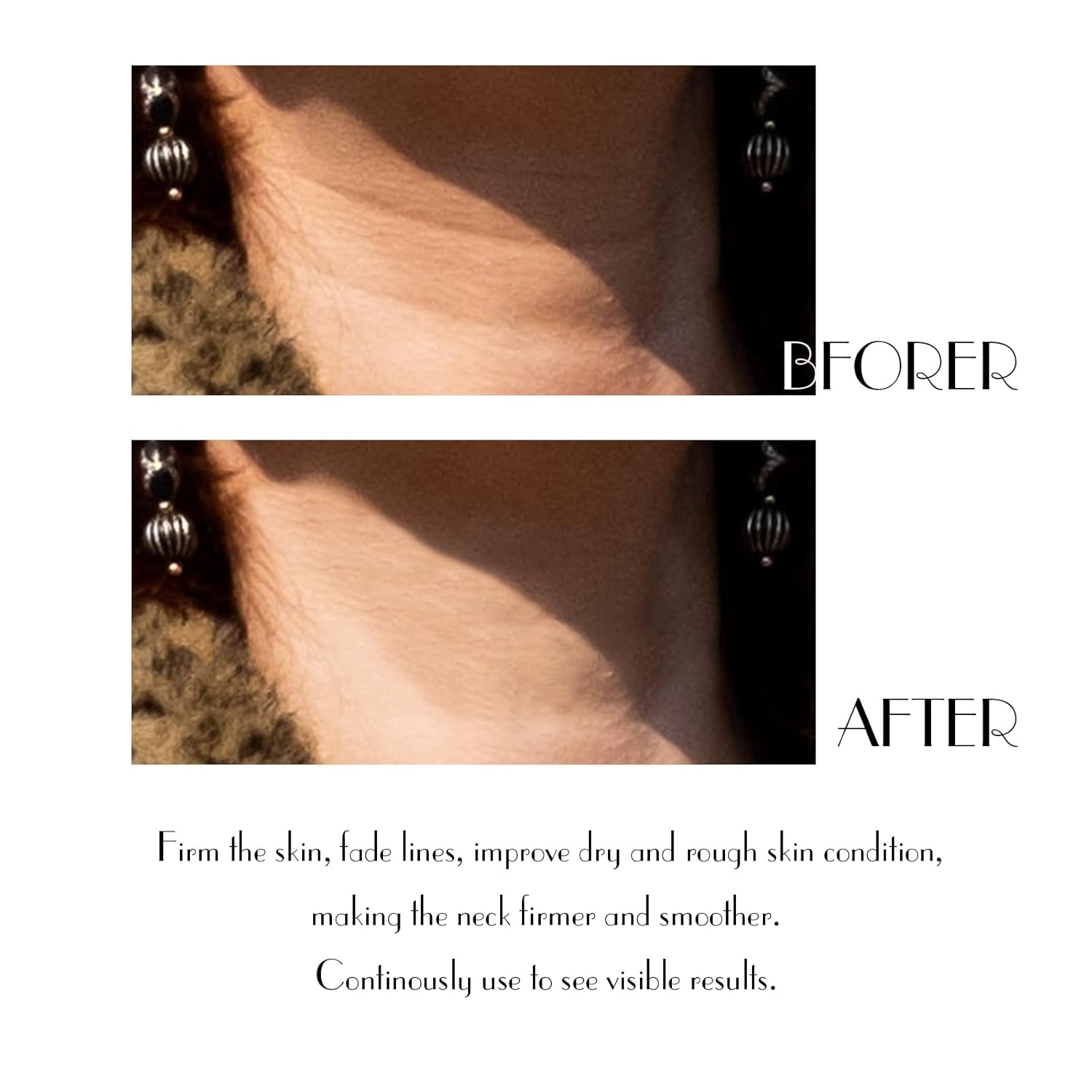 Neck Cream