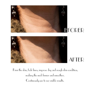 Neck Cream