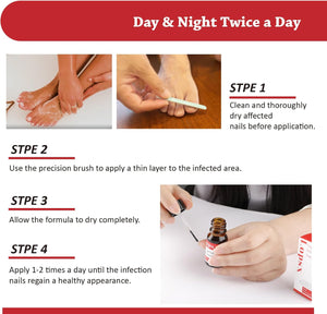 Fungal Nail Liquid Treatment