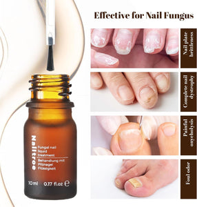 Fungal Nail Liquid Treatment
