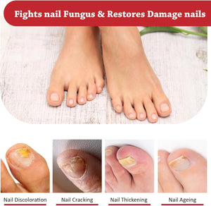 Fungal Nail Liquid Treatment